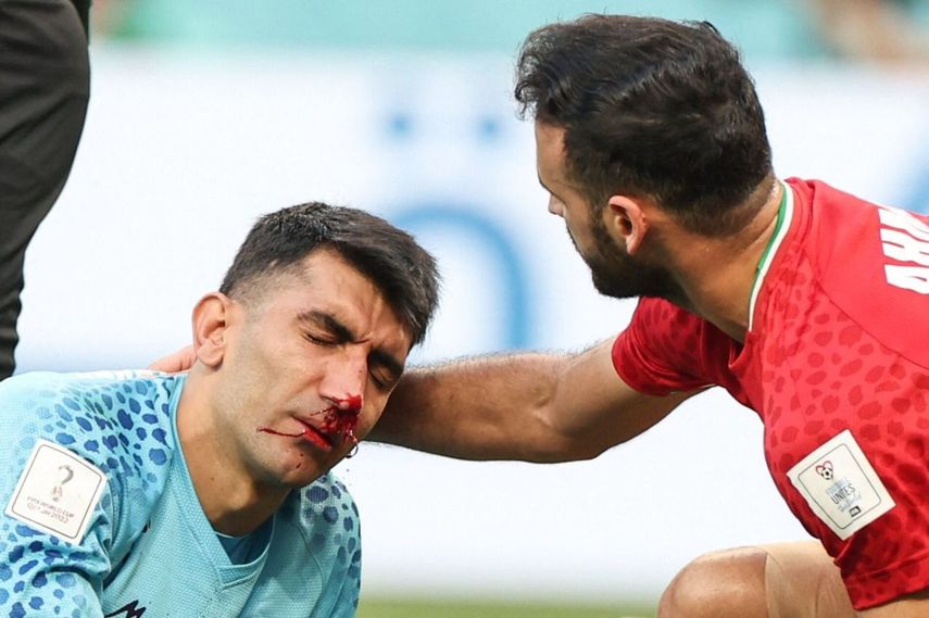 Qatar 2022: Portero iraní Beiranvand sufre fuerte lesión