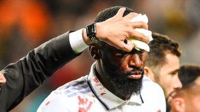 Champions League: Así quedó la camiseta de Rüdiger ante el Shakhtar