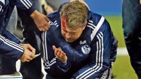 Segundo entrenador del Schalke es herido con un mechero