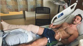 Francisco Narbón será operado de fractura de tibia y peroné y se pierde la temporada