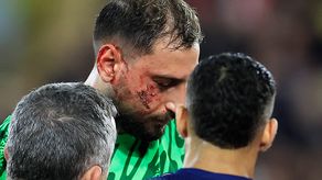 Wilfred Singo se disculpa tras fuerte golpe a Gianluigi Donnarumma