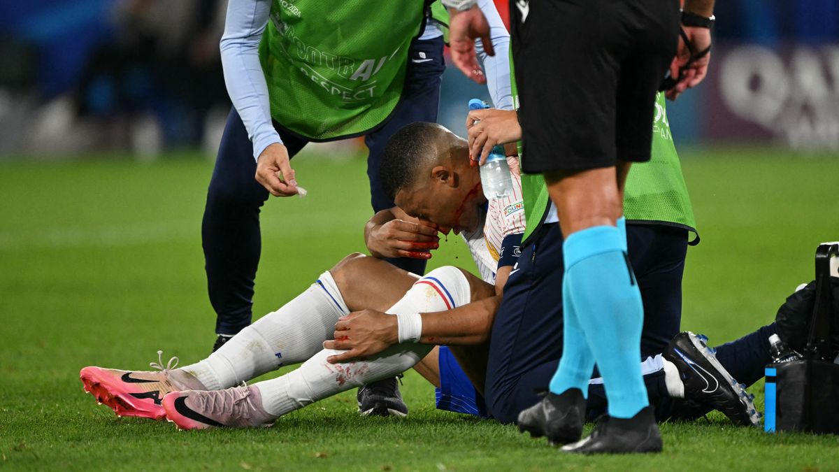 Eurocopa 2024: Kylian Mbappé sufrió una fractura en la nariz
