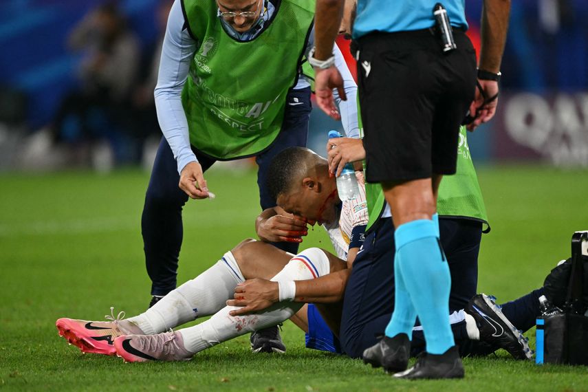 Eurocopa 2024: Kylian Mbappé sufrió una fractura en la nariz