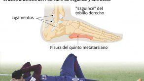 Con el Mundial en la cabeza
