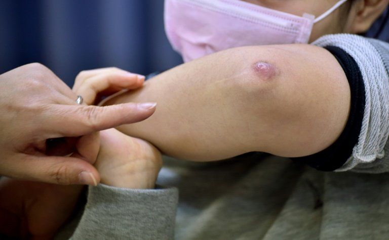 Kumitaiso, el ejercicio japonés que envía a urgencias a los niños
