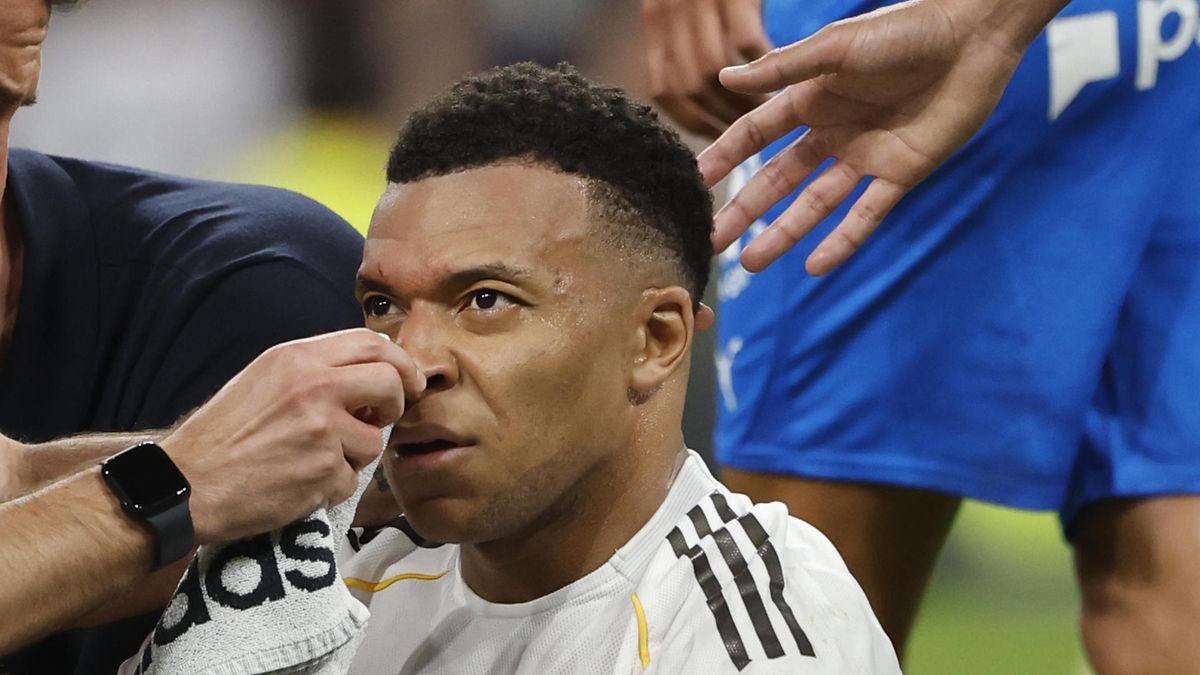 Kylian Mbappé no entrena con el Real Madrid por recibir puntos en su ceja