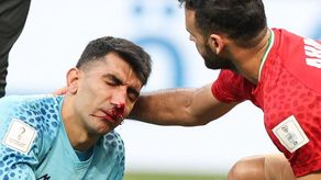 Qatar 2022: Portero iraní Beiranvand sufre fuerte lesión