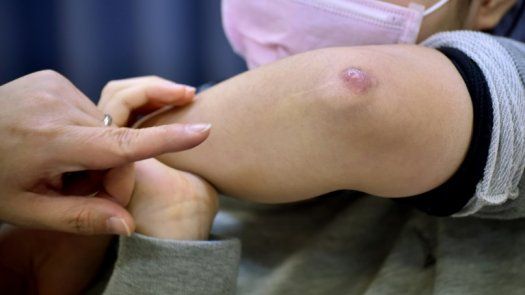 Kumitaiso, el ejercicio japonés que envía a urgencias a los niños