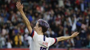 Federación EEUU dice que Selección masculina soporta más hostilidad que la femenina