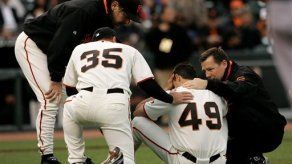 Lanzador de Gigantes sufre 3 fisuras craneales por pelotazo